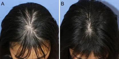Aryusutra Hair Growth Oil – Buy 1 Get 1 Sampoo FREE