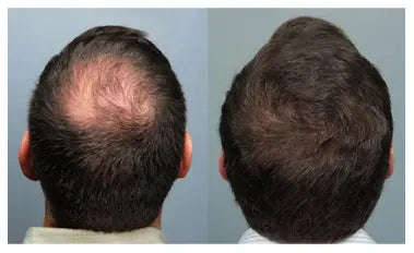 Aryusutra Ayurvedic Hair Oil for Hair Growth | Control Hair loss & Dandruff |