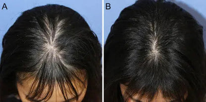 Aryusutra Ayurvedic Hair Oil for Hair Growth | Control Hair loss & Dandruff |