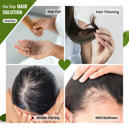 Hair loss Kit | Hair fall Control Kit | Aryusutra Health Hair loss Kit | Hair fall Control