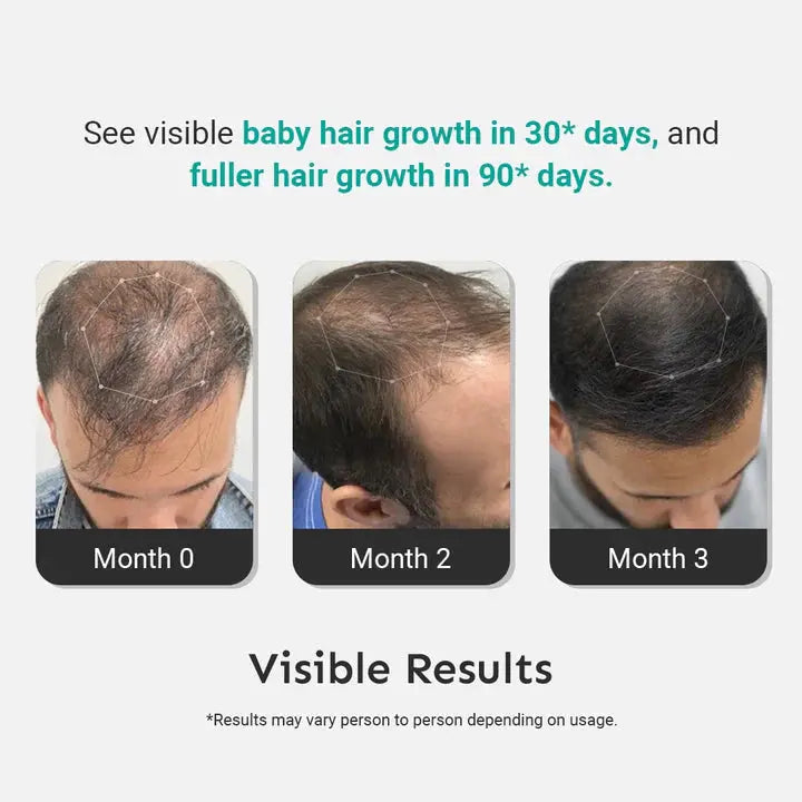 Hair loss Kit | Hair fall Control Kit | Aryusutra Health Hair loss Kit | Hair fall Control
