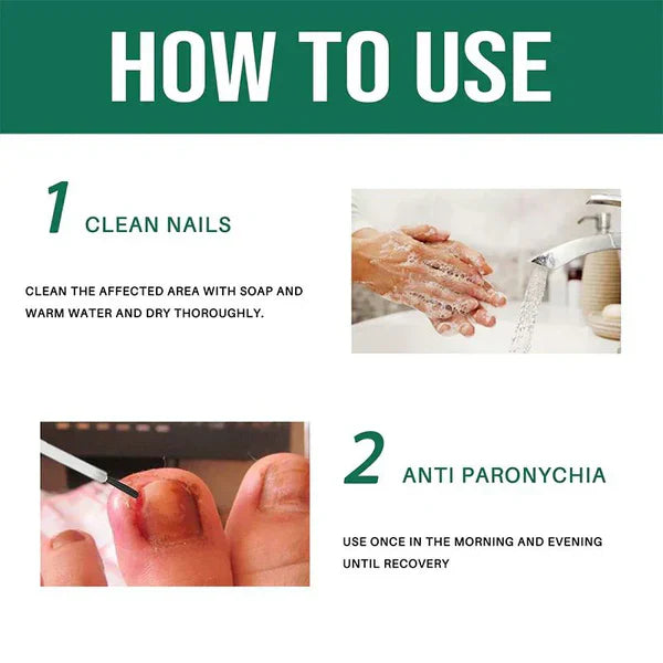 Anti Paronychia Relief Oil - (Buy 1 Get 1 FREE)