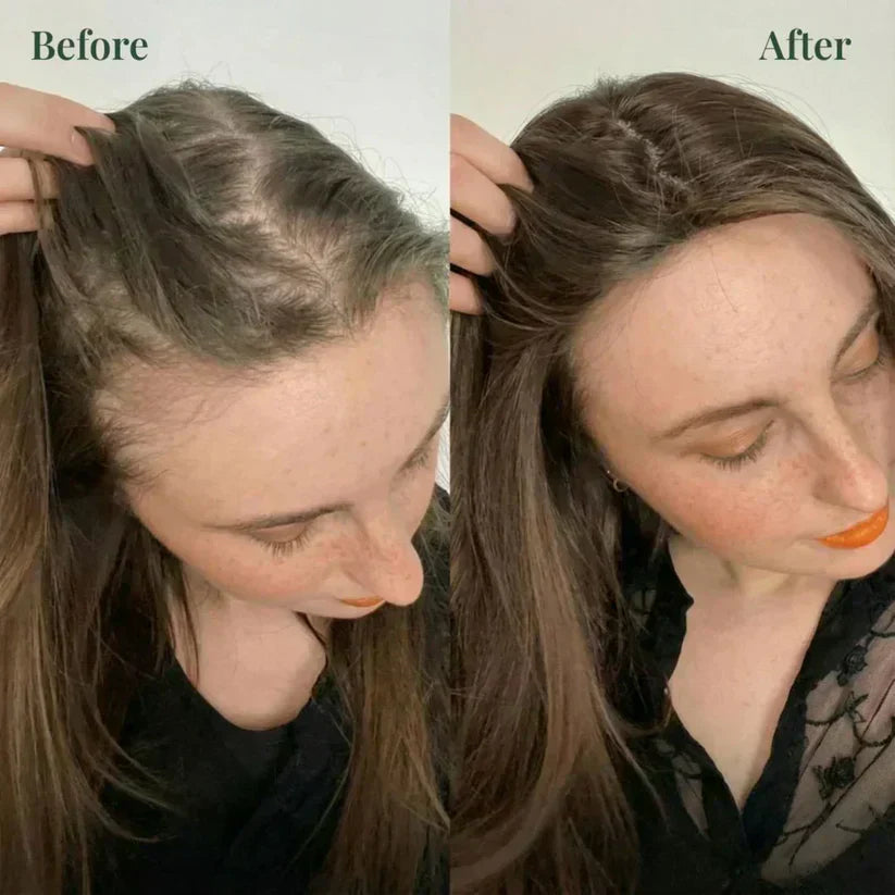 Kerarose Rosemary Shampoo For Hair Growth (Buy 1 Get 1 Free 🔥🔥)